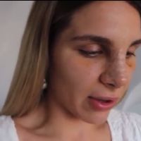 Ivana Icardi compartió los resultados de su operación de nariz: “¡Qué rara me veo!”