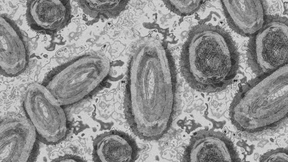 ortopoxvirosis simia