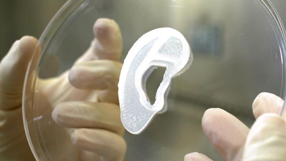 Cirujano implanta en paciente oreja impresa a partir de células humanas. 20220603