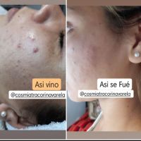 Cosmiatra Corina Varela