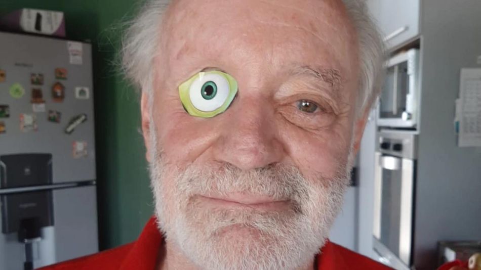 Un abogado y psicólogo tuerto dibujó un ojo en su parche 20220706