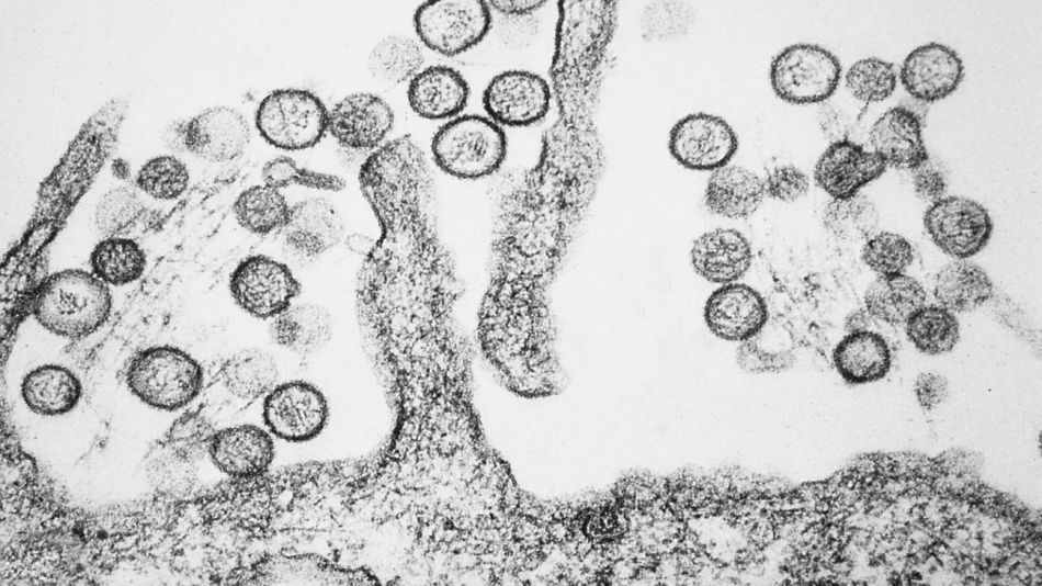 hantavirus 