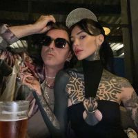 Cande Tinelli reveló el número exacto de cirugías que tiene