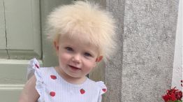 Layla Davis, de 17 meses, tiene el raro síndrome del cabello impeinable 20220725