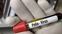 Poliomielitis Virus 20220802