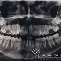 Dra. CARINA TITON ODONTOLOGÍA CONSCIENTE