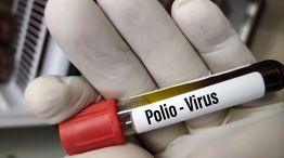 Poliomielitis Virus 20220802