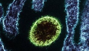 henipavirus 