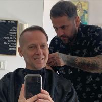 Matías Martin confirmó que se hizo un retoque estético