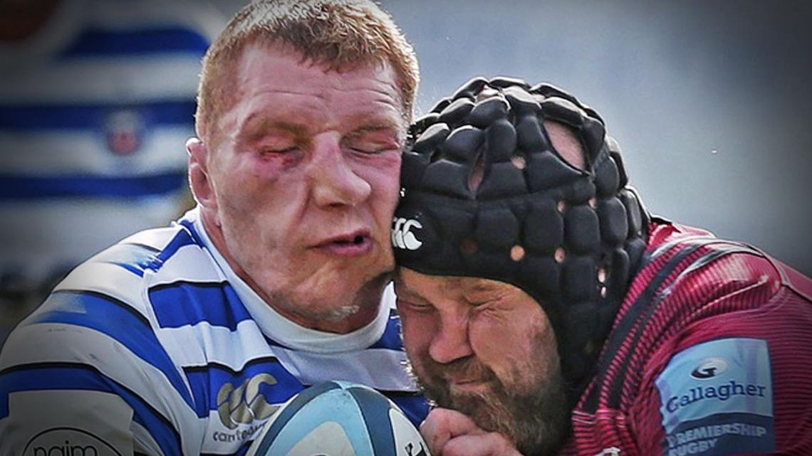 Collisions in rugby can be dangerous.