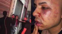patovicas golpearon jovenes tucuman g_20220922
