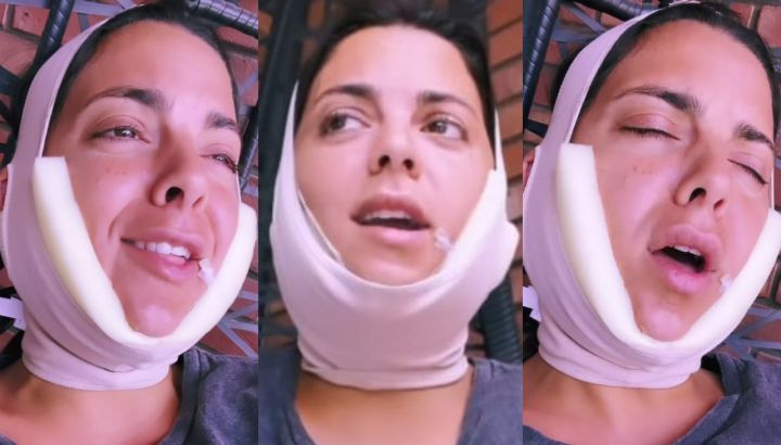 La cirugía estética a la que se sometió Belu Lucius: "Todavía tengo inflamación"