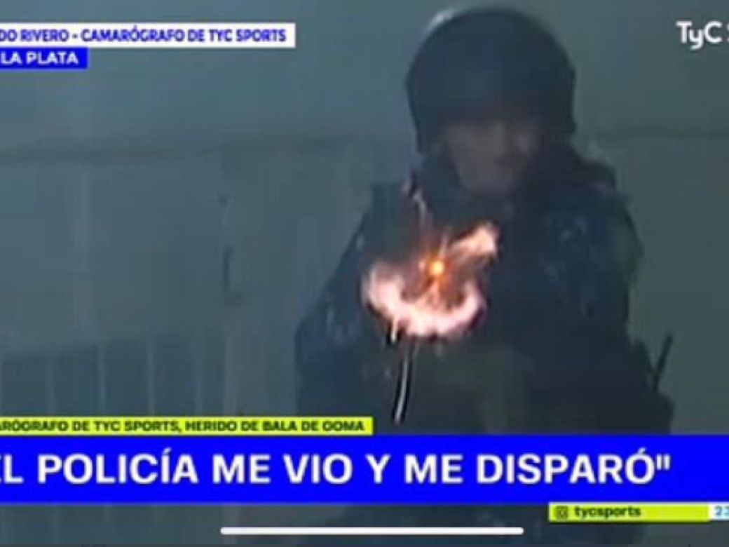 Un camarógrafo de TyC Sports recibió tres balazos de goma: "El policía estaba casi al lado mío, me ve y me tira..." | Perfil