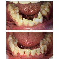 Seo Odontología