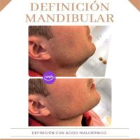 “Si existe exageración no es Armonización” Dra Ines Añó