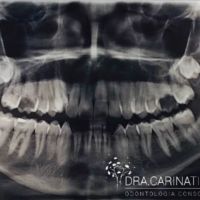 Dra. CARINA TITON ODONTOLOGÍA CONSCIENTE®
