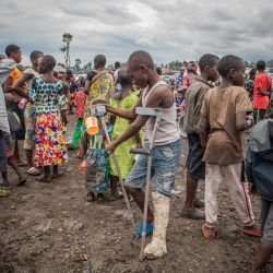 Un niño con una pierna enyesada hace cola para recibir comida preparada por voluntarios de Goma en la escuela primaria de Kayembe, en Kanyaruchinya, después de haberse refugiado allí mientras huía del conflicto entre las Fuerzas Armadas de la República Democrática del Congo (FARDC) y el M23 (Movimiento 23 de Marzo) en el territorio de Rutsuru, en la RDC. | Foto:Aubin Mukoni / AFP