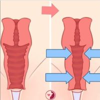 Ginecología estética no es sólo verse mejor