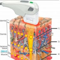 Ginecología estética no es sólo verse mejor