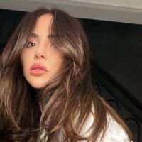 Cande Tinelli blanqueó una de sus operaciones estéticas más visibles