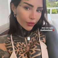 Cande Tinelli blanqueó una de sus operaciones estéticas más visibles