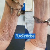 FUXPRÉCISE, El tratamiento ideal y a medida para tu piel
