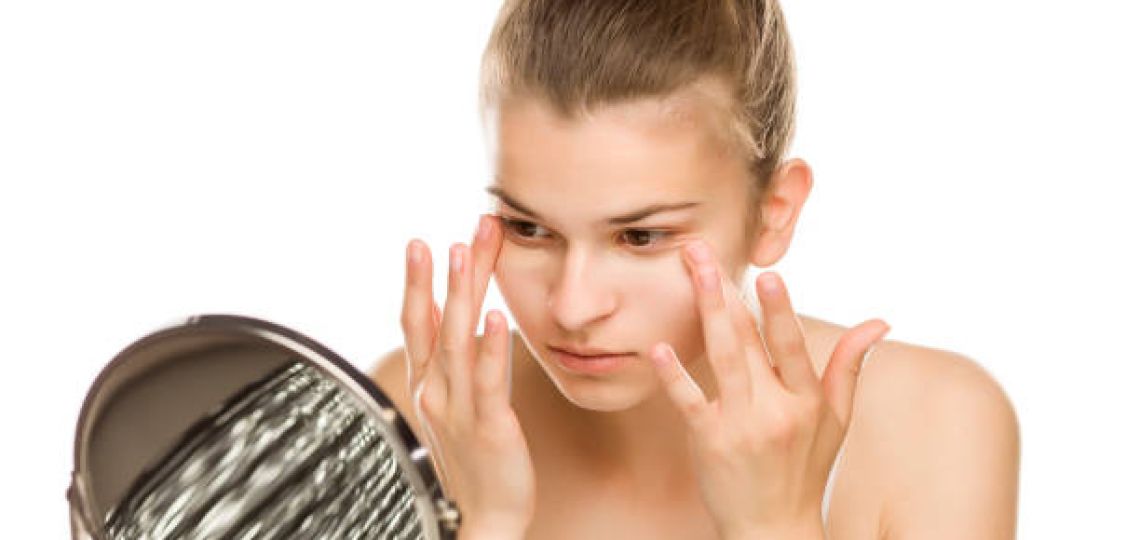 4 tratamientos caseros para mejorar las ojeras