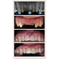 Transformando sonrisas