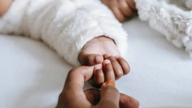 Caída del pelo posparto: tratamientos para disminuirla
