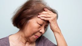 Accidente Cerebro Vascular