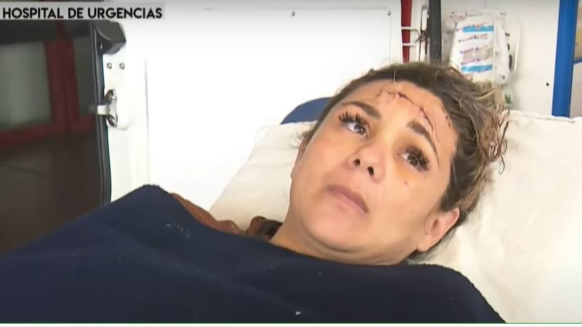 «Me hice la muerta para que no me maten»: le dispararon en la cabeza en un robo y sobrevivió «Me hice la muerta para que no me maten»: le dispararon en la cabeza en un robo y sobrevivió