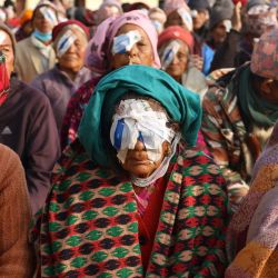 En esta fotografía unos pacientes esperan a que les desvendan los ojos tras una operación en un campamento de cataratas en Basantapur. Nepal tiene una de las tasas más altas del mundo de cataratas, una enfermedad en la que el cristalino del ojo se nubla lentamente y la visión se vuelve borrosa antes de dar paso a la ceguera. Las causas son múltiples, pero en el mundo en desarrollo la pobreza es un factor clave. | Foto:Sebastien Berger / AFP