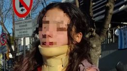 Golpearon brutalmente a una nena de 12 años en una escuela de La Plata