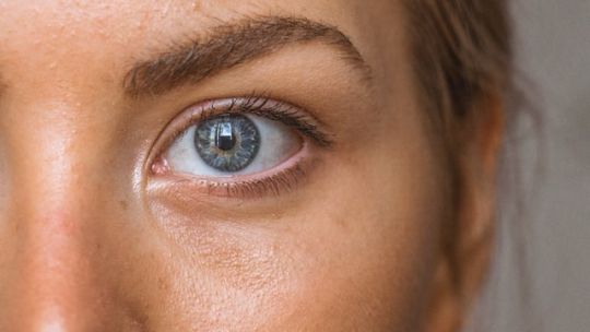 ¡Adiós al brillo! Tips para controlar el exceso de grasa en tu piel