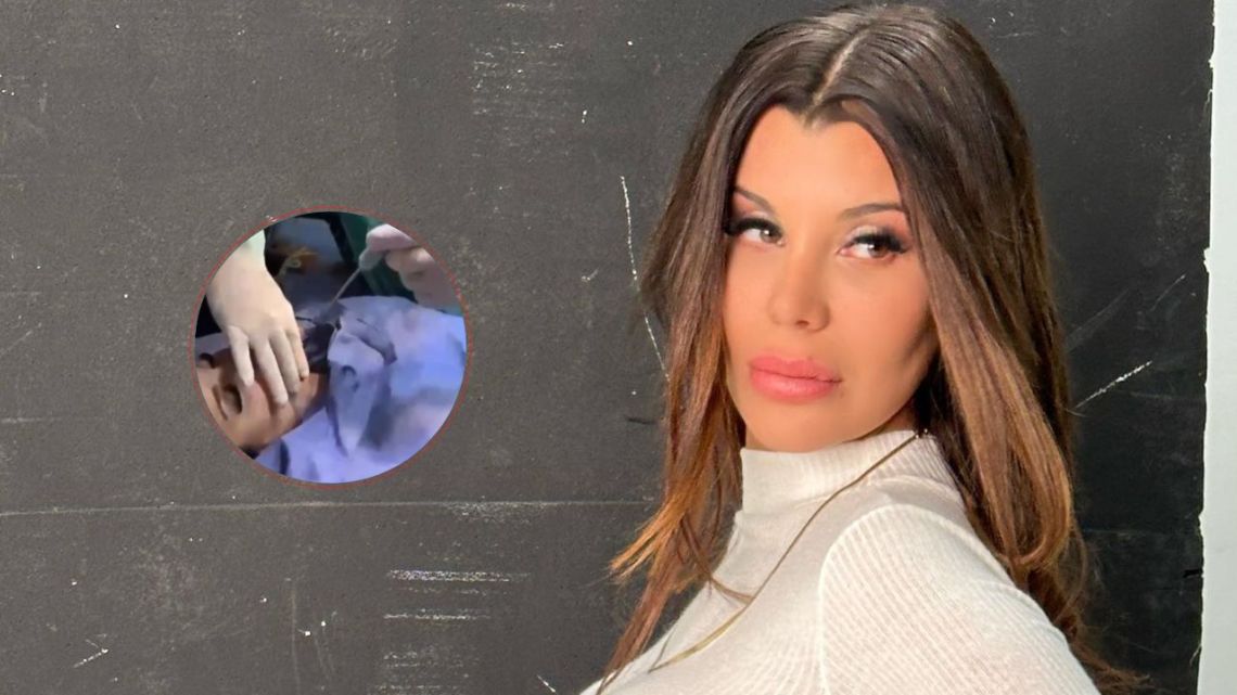 Charlotte Caniggia causó revuelo con un impactante video desde el quirófano: "Retoque estético