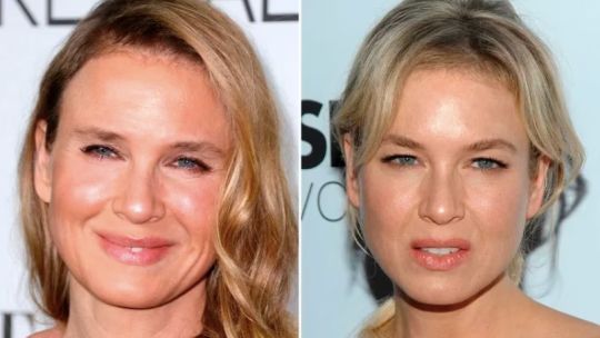 Antes y después de Reneé Zellweger.