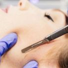 Peeling y lo último en tendencias