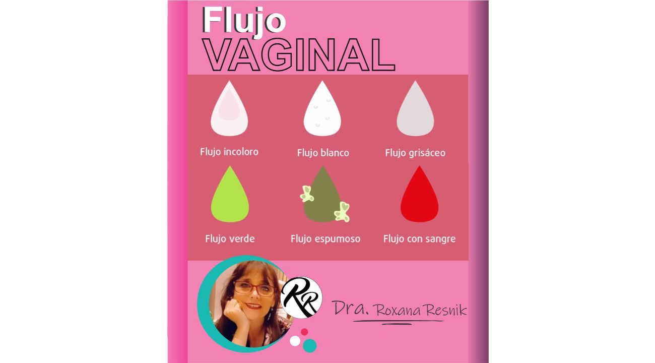 Flujo vaginal normal o anormal ¿Cuándo consultar?