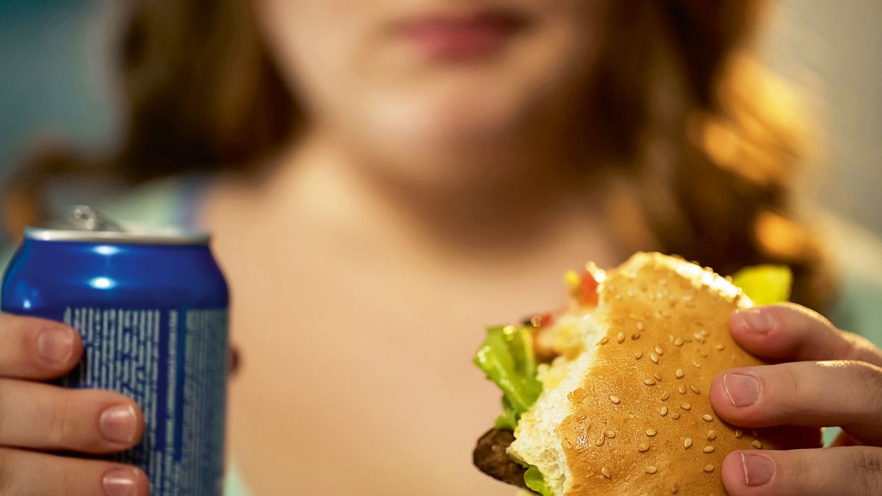 Obesidad. | Foto:Shutterstock.