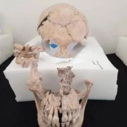 Un examen al que fueron sometidos los restos óseos hallados sugiere que algunos de los hombres habían sufrido caries