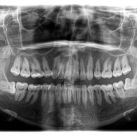 15 Cosas que no sabías de la Ortodoncia 
