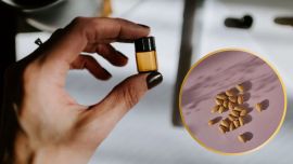 Aceite de almendras: beneficios del mejor aliado para tu piel, pelo y uñas