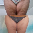 Smart Body Argentina 