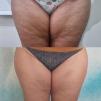 Smart Body Argentina 