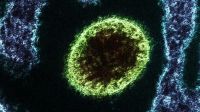 Nipah se transmite de animales a personas.