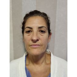 ¿Te molestan las bolsas de los párpados? Acá tenés la solución. | Foto:CEDOC