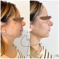 Dra Luciana Fernandes: Lifting líquido, la evolución de la medicina estética 