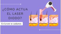 El láser diodo y cómo actúa en depilación definitiva  