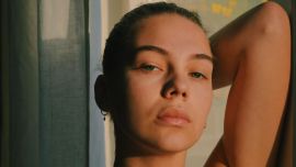 Cuáles son los beneficios del ácido láctico, el nuevo aliado de tu rutina de skincare