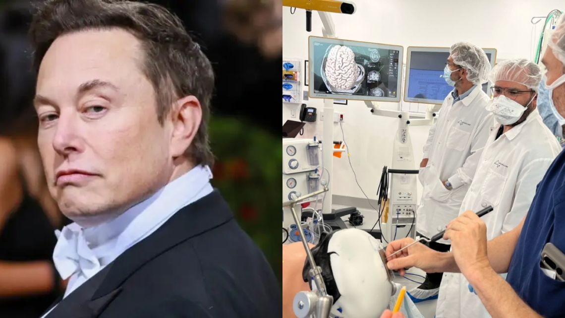 Elon Musk Anunció Que Su Empresa Neuralink Realizó Su Primer Implante